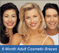 Adult Cosmetic Braces